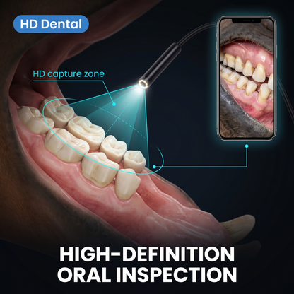Chevaroo Dental Health Intraoral Camera
