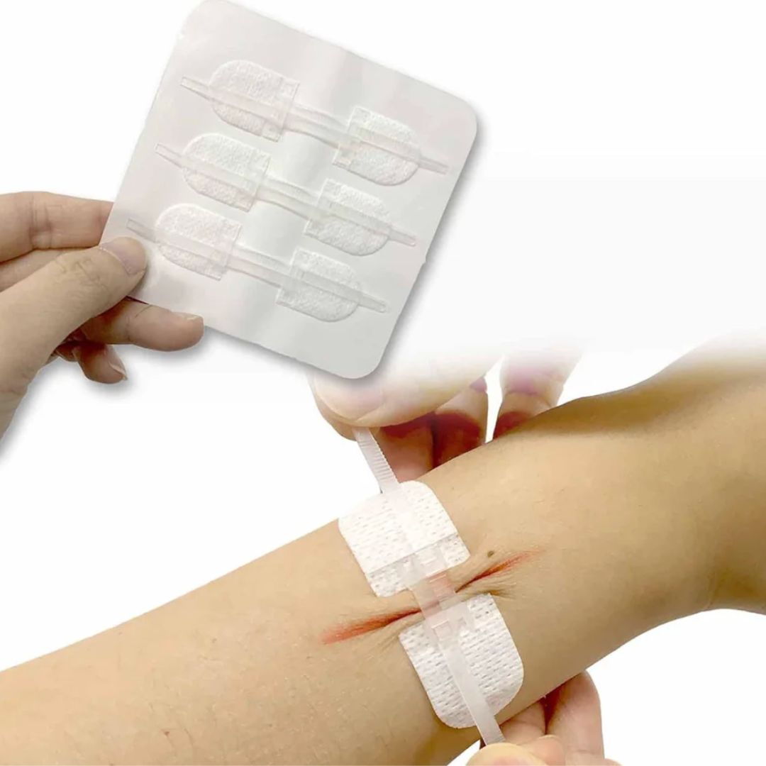 Chevaroo Horse Wound Closure Strip Kit